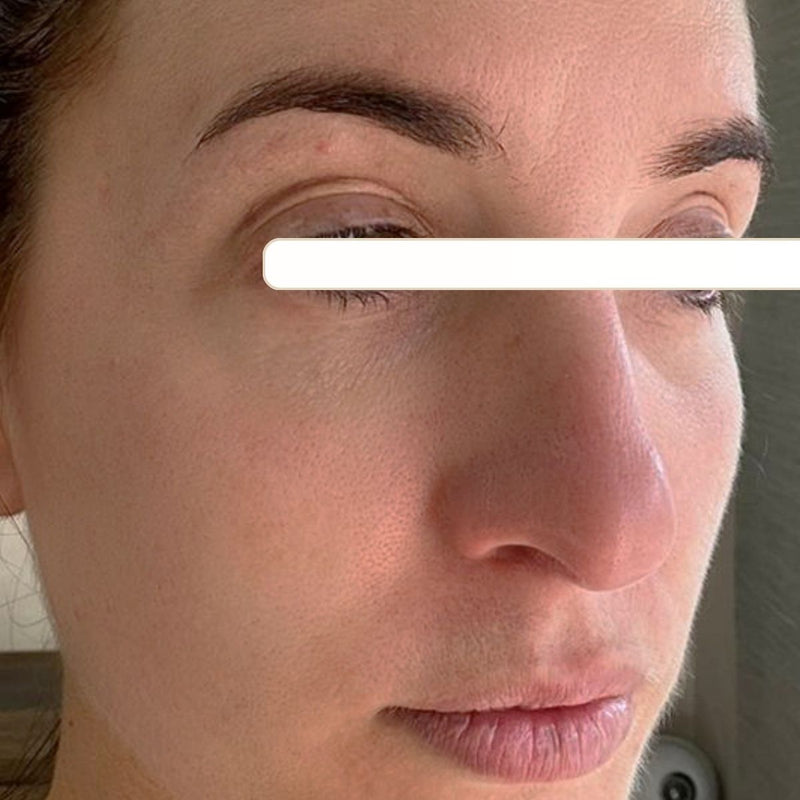 After treatment