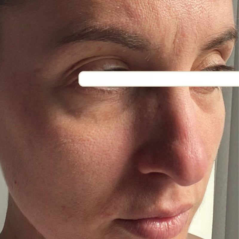 Before treatment
