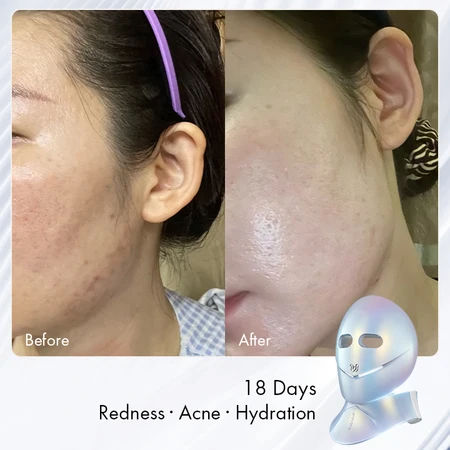 Kết quả sau 18 ngày
