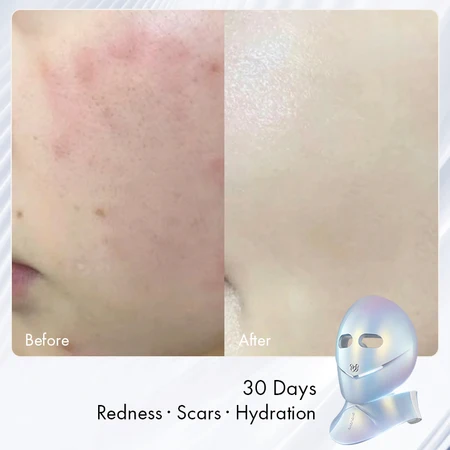 Kết quả sau 30 ngày